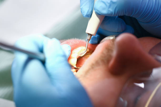 Best Emergency Gum Pain Relief  in Cool Valley, MO
