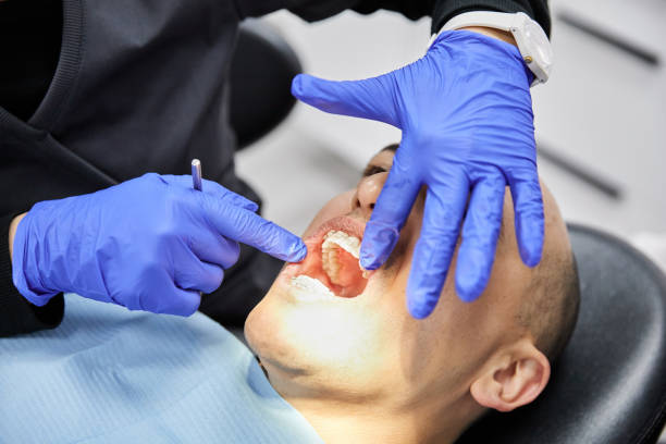 Best Urgent Tooth Repair  in Cool Valley, MO